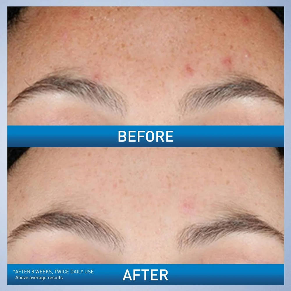 CeraVe Retinol Serum