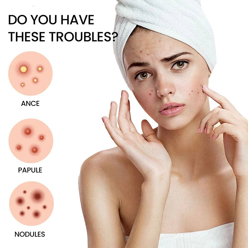 200Pcs Acne Pimple Patch Sticker - SweeTee Beauty leak-proof panties