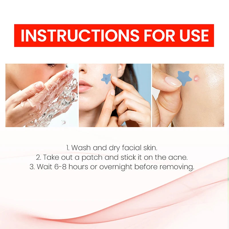 200Pcs Acne Pimple Patch Sticker - SweeTee Beauty leak-proof panties